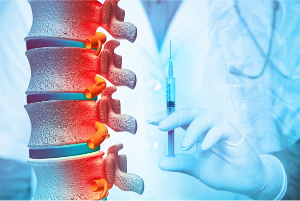 Perineural Injection Therapy (PIT)