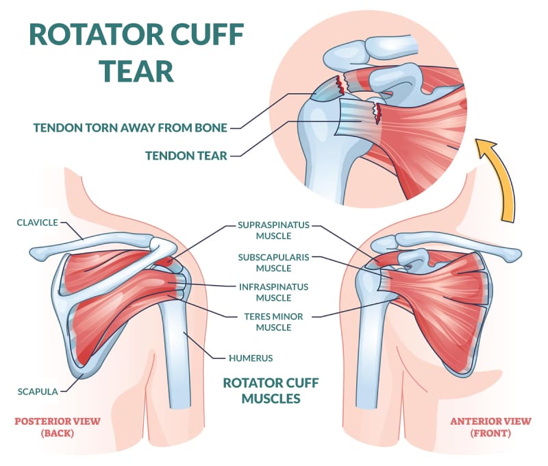 Diagram of a rotator cuff including all of the associated muscles and bones