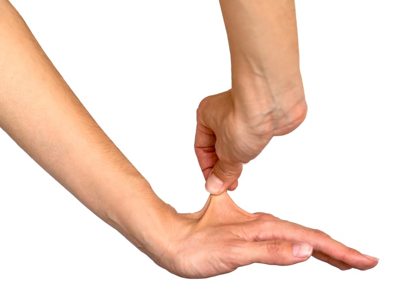 Close Up of a hand pinching skin of another hand